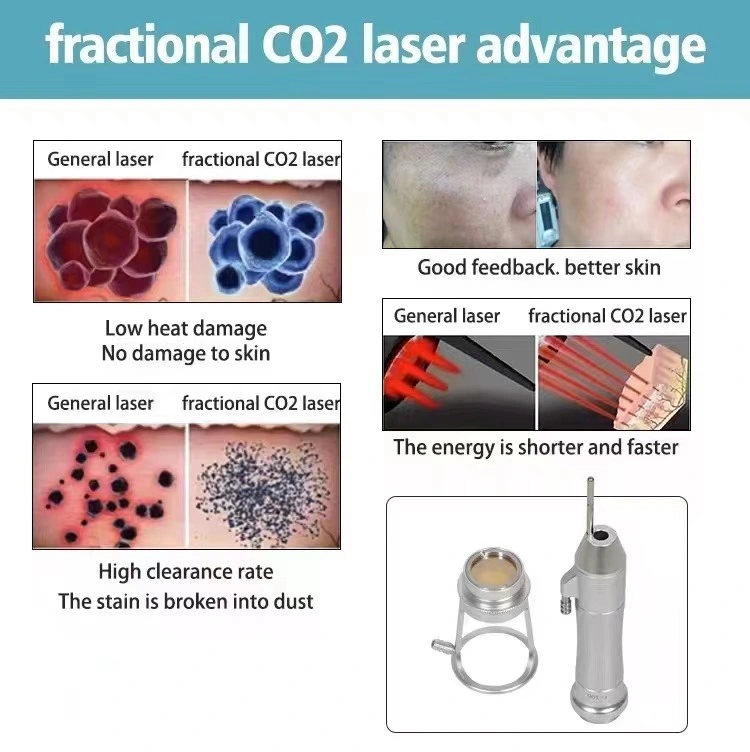 Dermatology Equipment Erbium Laser Resurfacing Fractional CO2 Laser CO2 Fraccionado CO2 Fractional Laser